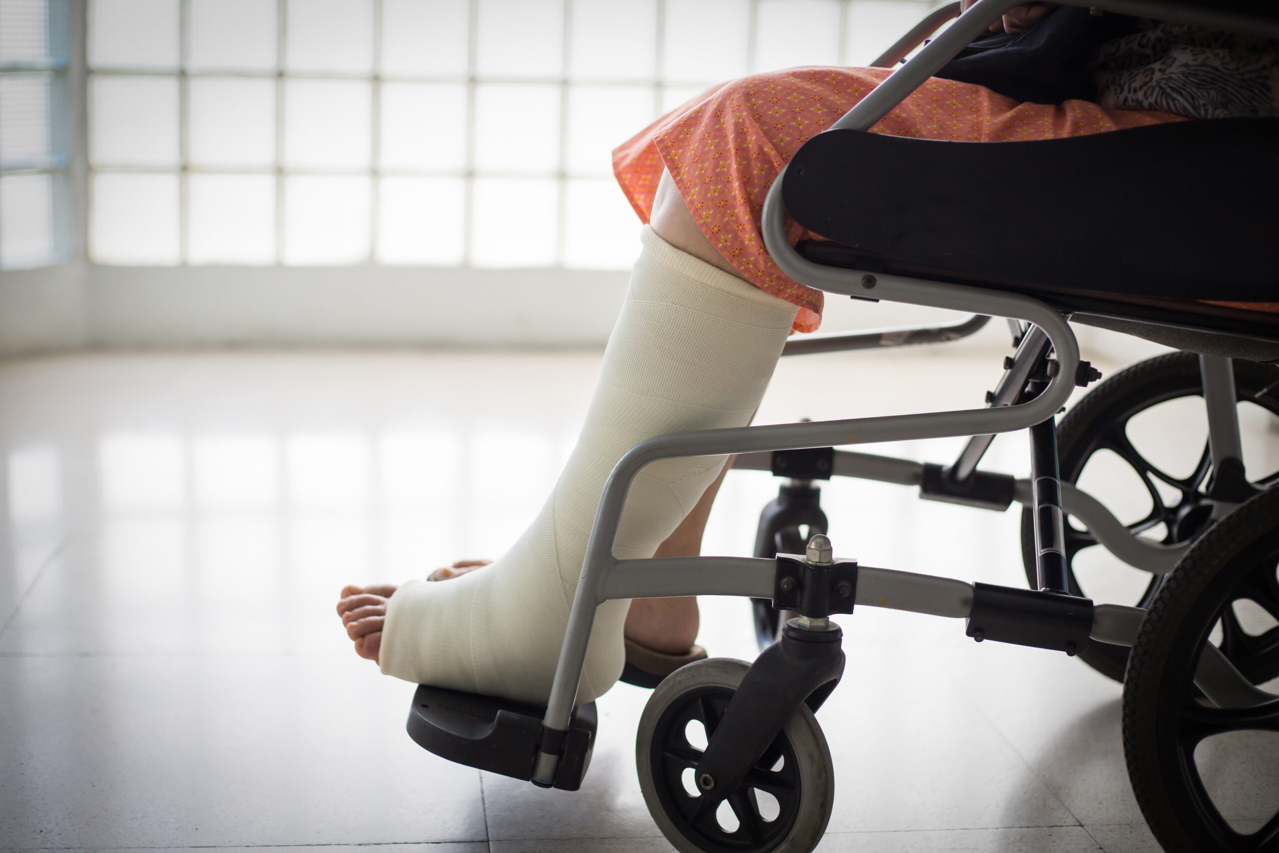 adult leg injury sitting on wheelchair with plaster foot.