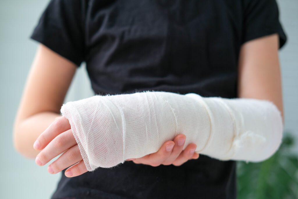 Close-up of a broken arm of a child in a cast. The girl holds her hand bent on the background of a black t-shirt. injured in a personal injury accident involving a car